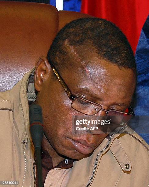 Scar is seen on the head of Guinean junta chief Captain Moussa Dadis Camara as he signs a pact on Januray 15, 2010 in Ouagadougou during a meeting...