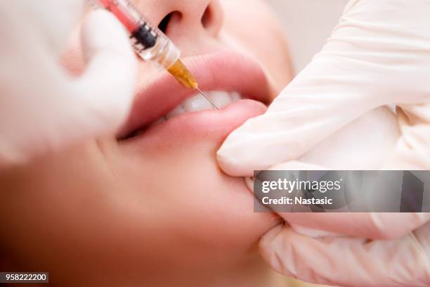 professionele schoonheidsspecialist injecteren van siliconen in lippen - lip injections stockfoto's en -beelden