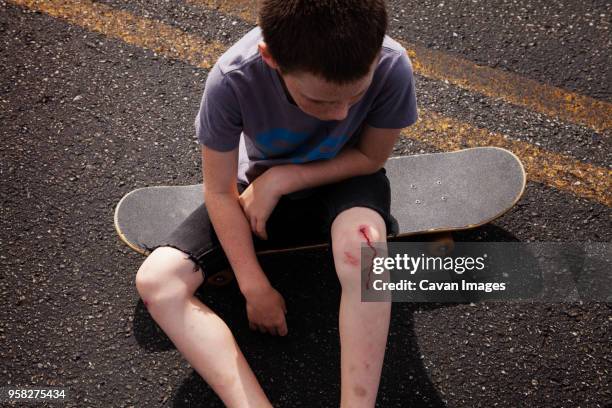 high angle view of boy with wounded knee sitting on skateboard - male knee stock pictures, royalty-free photos & images