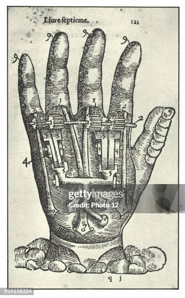 Artificial hand by Ambroise Pare .