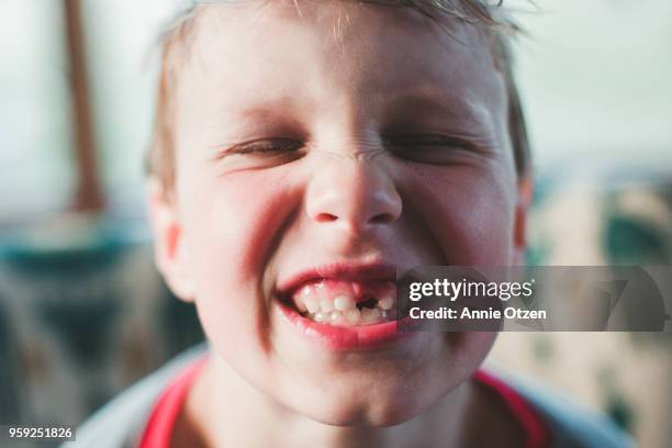 boy with missing tooth smiling - tothless boys stock-fotos und bilder