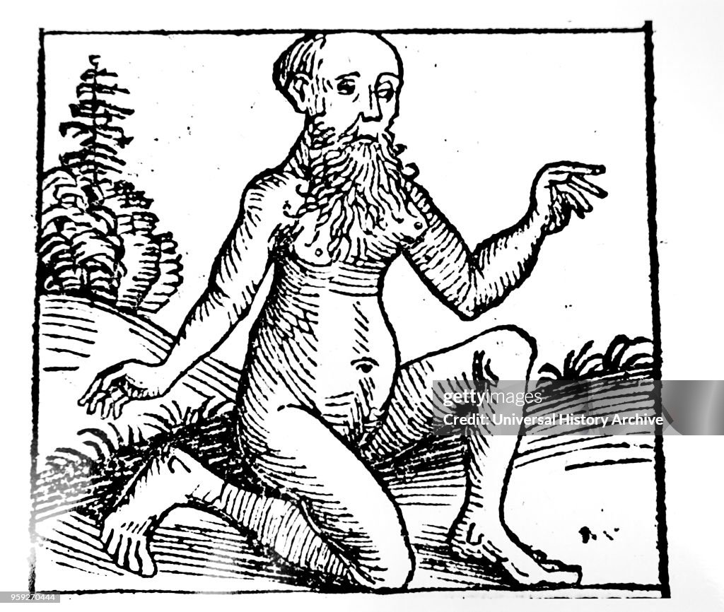A beared man with breasts.