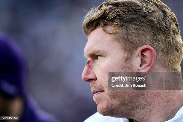 Matt Birk of the Baltimore Ravens looks on as blood drips from the bridge of his nose against the New England Patriots during the 2010 AFC wild-card...