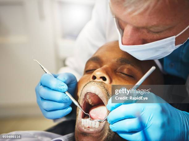tandarts werken aan patiënt tanden - dental explorer stockfoto's en -beelden