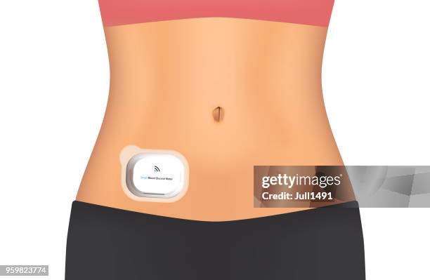 smart glucose meter located on the stomach. realistic vector - patience illustration stock illustrations