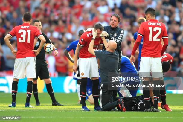 Physicians tend to an injury on the eye of Phil Jones of Man Utd during the Emirates FA Cup Final between Chelsea and Manchester United at Wembley...