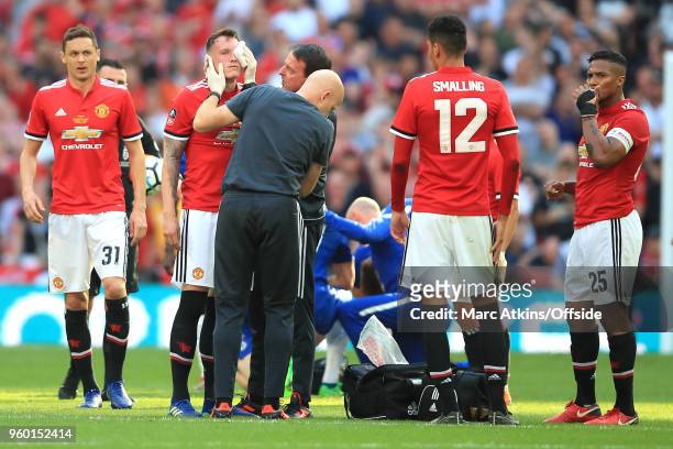 Physicians tend to a head injury on Phil Jones of Man Utd during the Emirates FA Cup Final between Chelsea and Manchester United at Wembley Stadium...