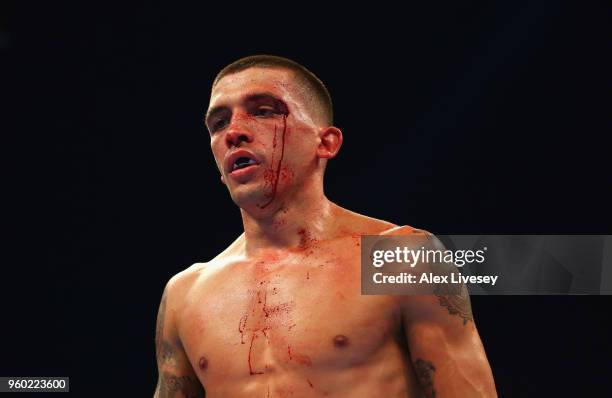 Lee Selby is cut during IBF Featherweight Championship fight at Elland Road on May 19, 2018 in Leeds, England.