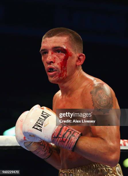 Lee Selby is cut during IBF Featherweight Championship fight at Elland Road on May 19, 2018 in Leeds, England.