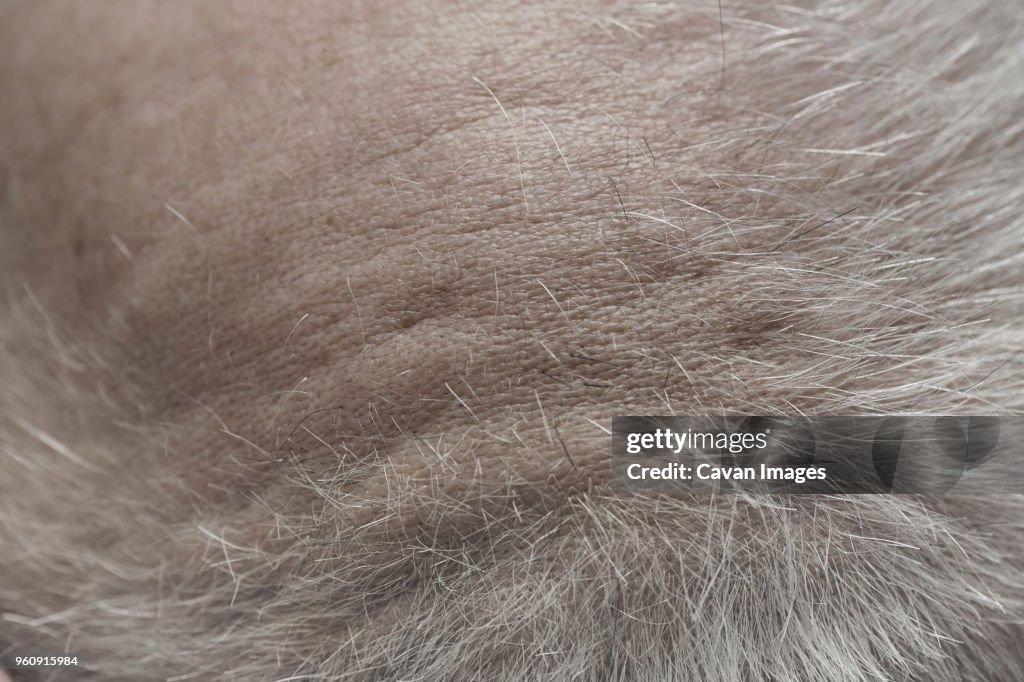 Overhead view of mans scalp