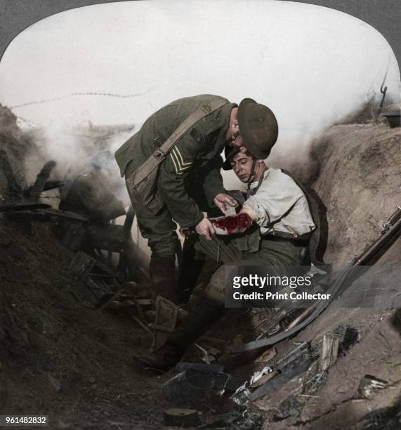 Soldier receiving first aid from a sergeant in a sap, Battle of Peronne, France, World War I, 1914-1918. Stereoscopic card detail. . Artist Realistic...