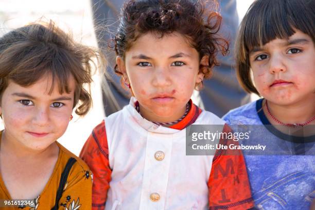 April 23: Three little girls with facial wounds in the refugee camp Kabarto 2 in the District Semeel on April 23, 2018 in DOHUK, IRAQ.