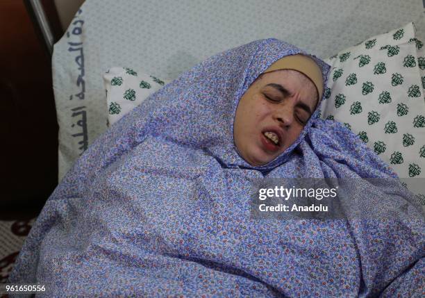 Palestinian Ala es-Sevafiri, whose mother Intisar es-Sevafiri affected from tear gas canisters by Israeli forces' intervention during protests in...