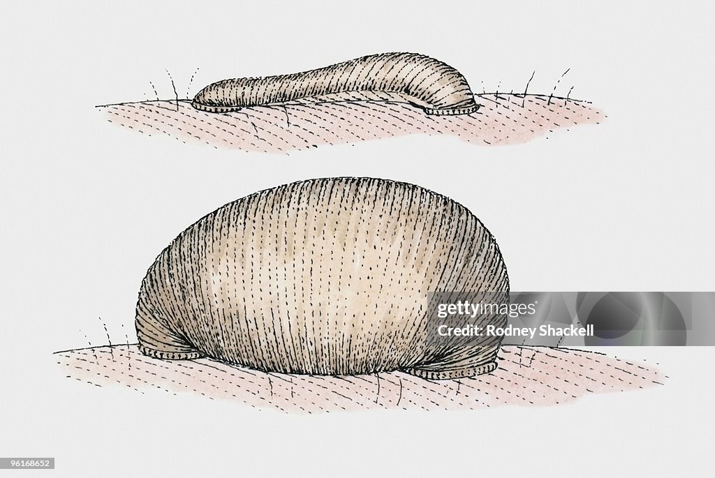 Illustration of leech before and after sucking blood