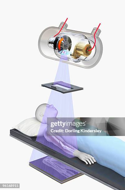 illustration of x-ray machine being used on a patient - patient lying on back stock illustrations
