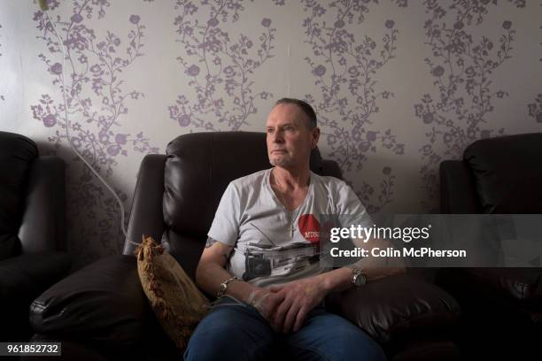 Former international footballer Paul 'Gazza' Gascoigne undergoing a nutrient infusion at Cassiobury Court, a drug and alcohol rehabilitation clinic...