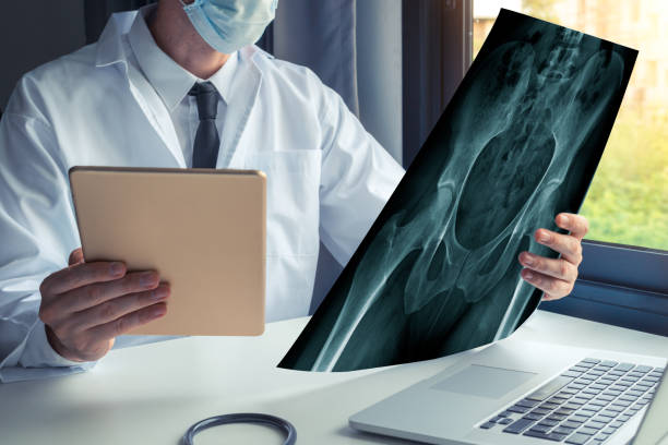 How to Find the Best Hip Surgeons in the United States