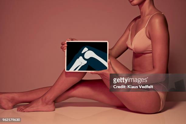 young woman holding tablet in front of leg to display knee bone - leg show fotografías e imágenes de stock