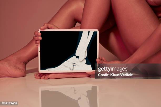 young woman holding tablet in front of foot to view foot bone - foot bone stock pictures, royalty-free photos & images