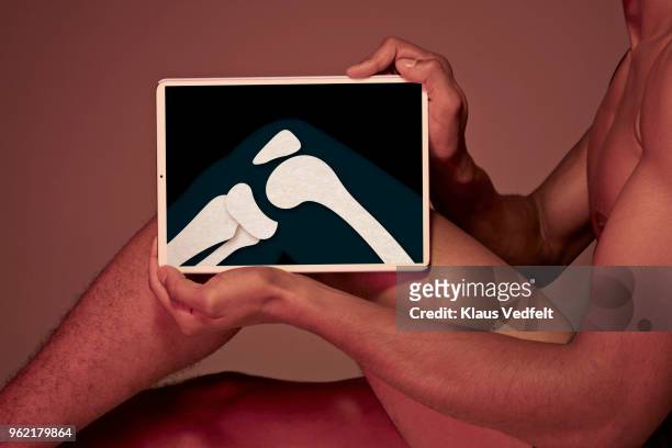 young man holding tablet in front of leg to display knee bone - fibula foto e immagini stock