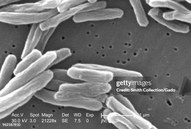 Ultrastructural details of Gram-positive Mycobacterium tuberculosis bacteria revealed in the 21228x magnified scanning electron microscopic image,...