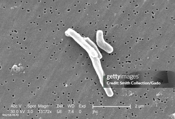 Gram-positive Mycobacterium tuberculosis bacteria revealed in the 13172x magnified scanning electron microscopic image, 2006. Image courtesy Centers...