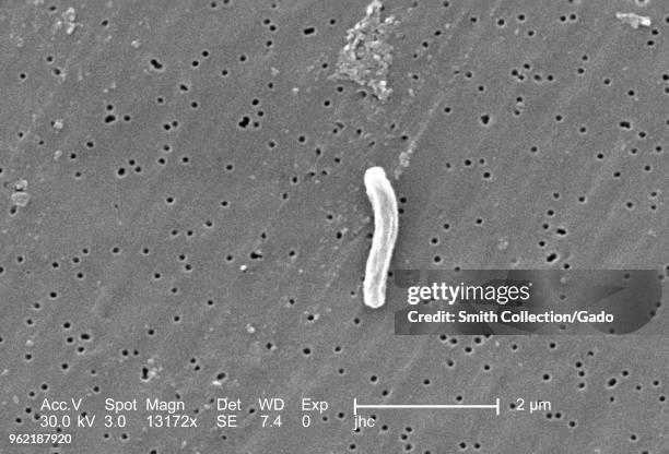 Single Gram-positive Mycobacterium tuberculosis bacterium revealed in the 13172x magnified scanning electron microscopic image, 2006. Image courtesy...