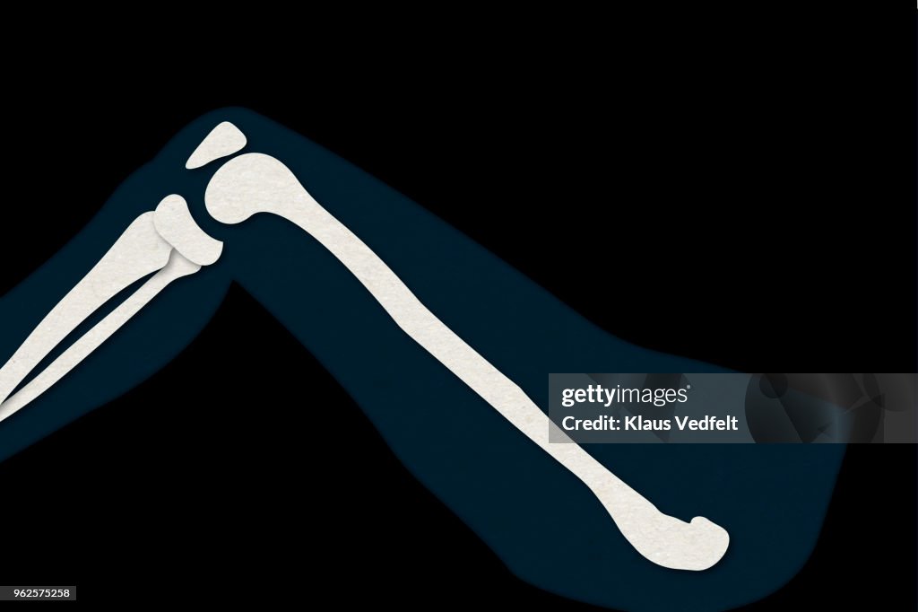 Illustration of human leg bones