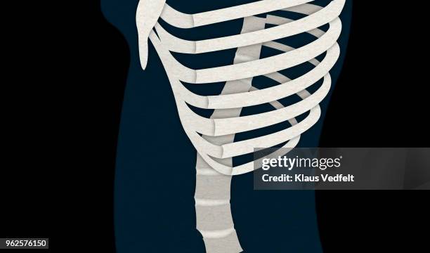Back Rib Injuries 724 Rib Injury Stock Photos, High-Res Pictures, and Images - Getty Images