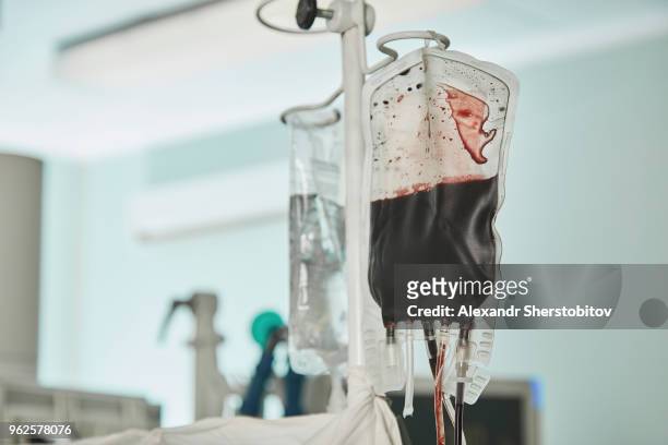 close-up of blood bag hanging in hospital ward - blood bag foto e immagini stock