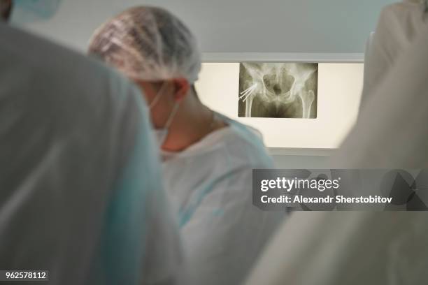 surgeons working in operating room with medical x-ray on screen - sherstobitov stock pictures, royalty-free photos & images