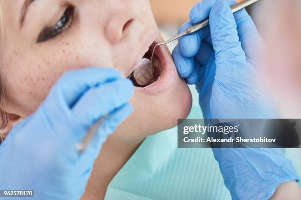 cropped image of dentist using equipment while examining patient's mouth at hospital - sherstobitov stock pictures, royalty-free photos & images