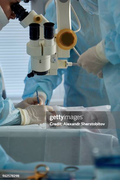 surgeons performing eye surgery on patient at hospital - microchirurgie stockfoto's en -beelden