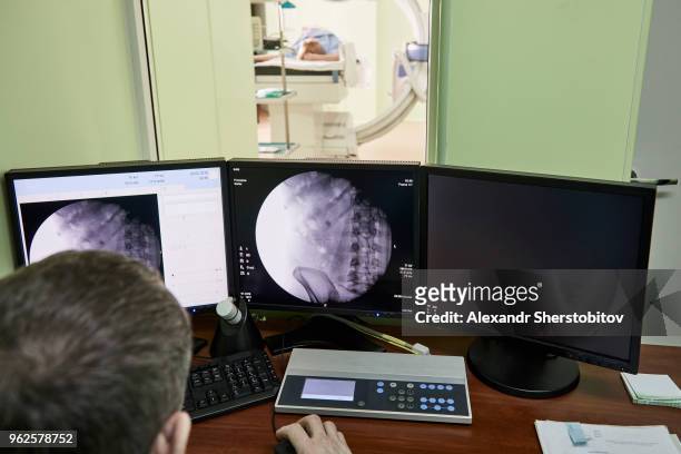 high angle view of doctor looking at medical x-rays on computer in hospital - sherstobitov stock pictures, royalty-free photos & images