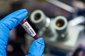 Nipah virus positive blood sample