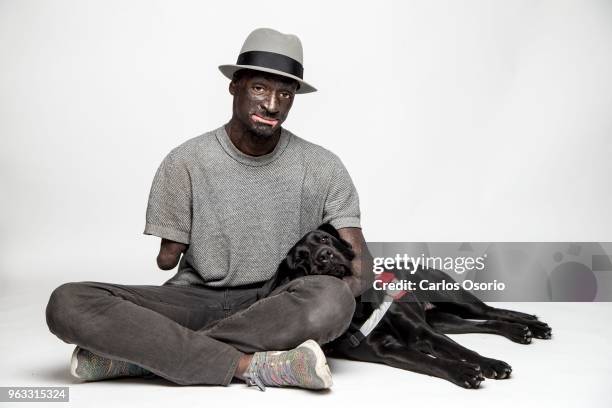 Toronto actor Prince Amponsah with his service dog, Siri. Prince lost his lower arms in a fire, suffered burns to 68 percent of his body and relies...