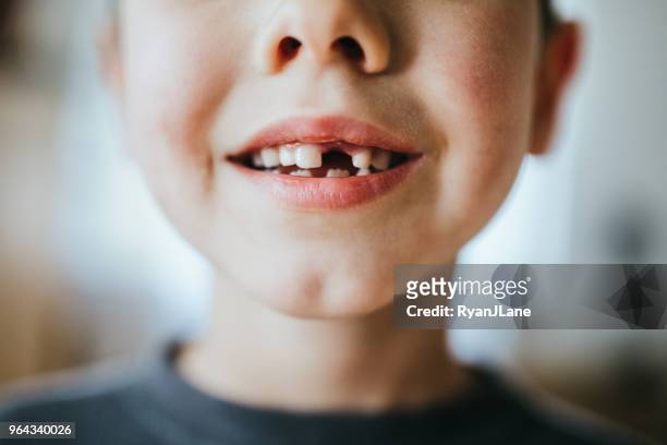 jongen pronkt ontbreekt tand - spleetje stockfoto's en -beelden