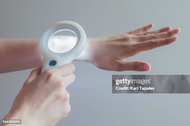 using a magnifying lens for skin - melanoma fotografías e imágenes de stock