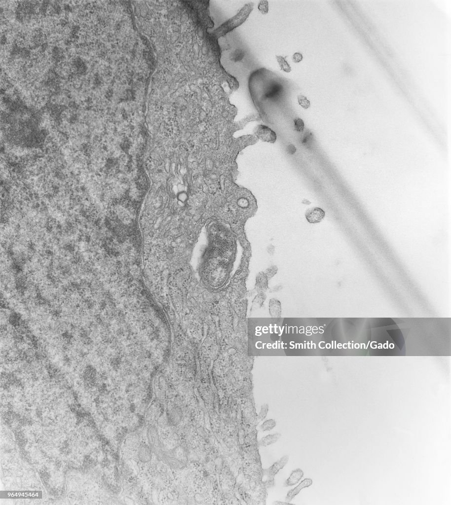 Orientia Tsutsugamushi