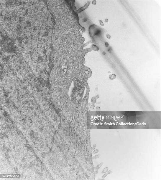 Hypertrophic peritoneal mesothelial cell from a mouse experimentally infected intraperitoneally with Orientia tsutsugamushi rickettsial...