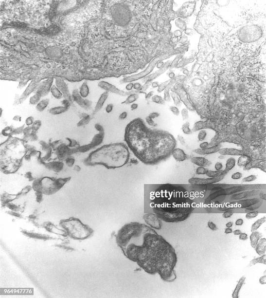 Peritoneal mesothelial cells from a mouse experimentally infected intraperitoneally with Orientia tsutsugamushi rickettsial micro-organisms, revealed...