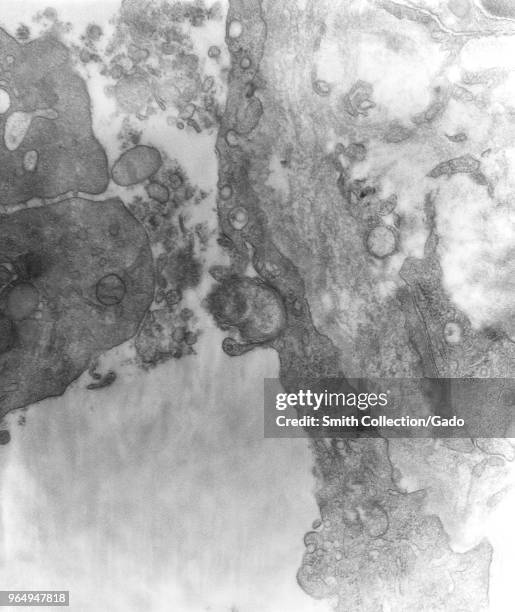 Peritoneal mesothelial cell from a mouse experimentally infected intraperitoneally with Orientia tsutsugamushi rickettsial micro-organisms, revealed...
