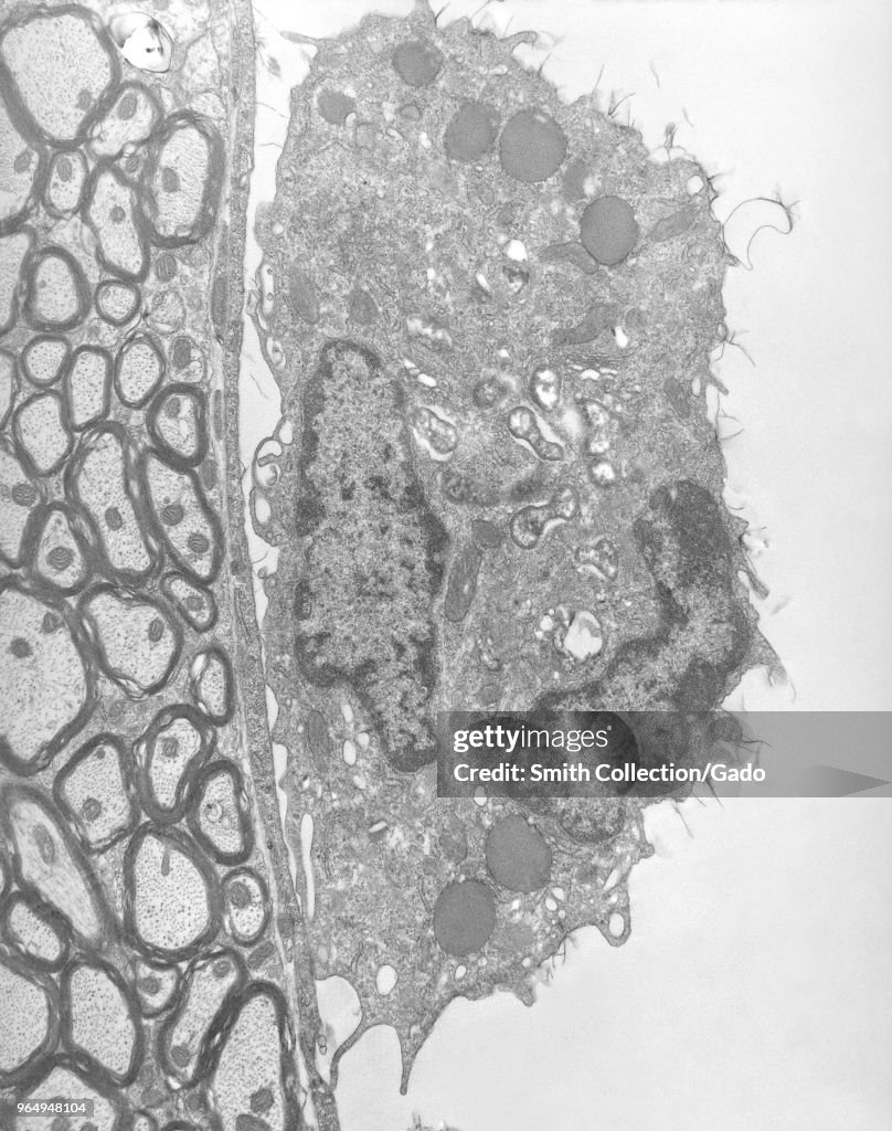 Orientia Tsutsugamushi