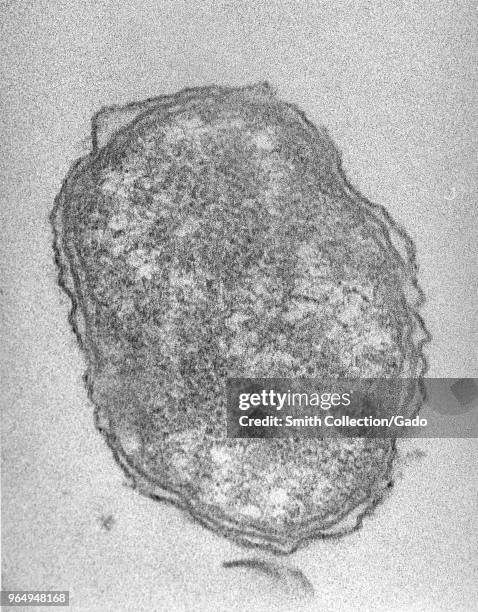 Extracellular Orientia tsutsugamushi rickettsial micro-organism covered with a distinct third outer membrane, revealed in the transmission electron...