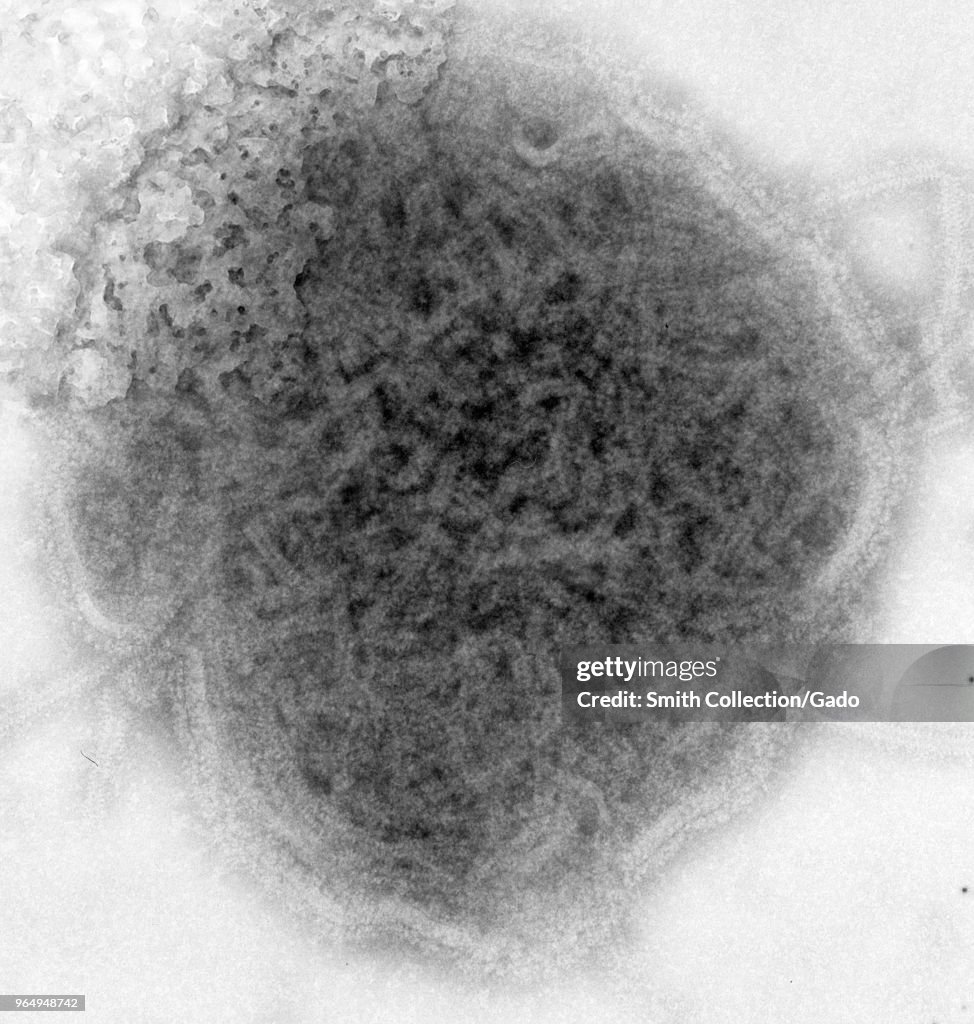 Mumps Virus