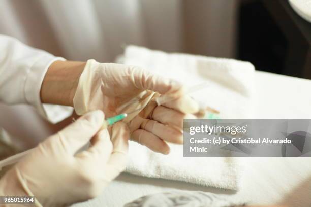 surgeon preparing syringe - carabobo stock-fotos und bilder