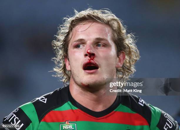 George Burgess of the Rabbitohs looks on with a bloodied nose during the round 13 NRL match between the South Sydney Rabbitohs and the Cronulla...
