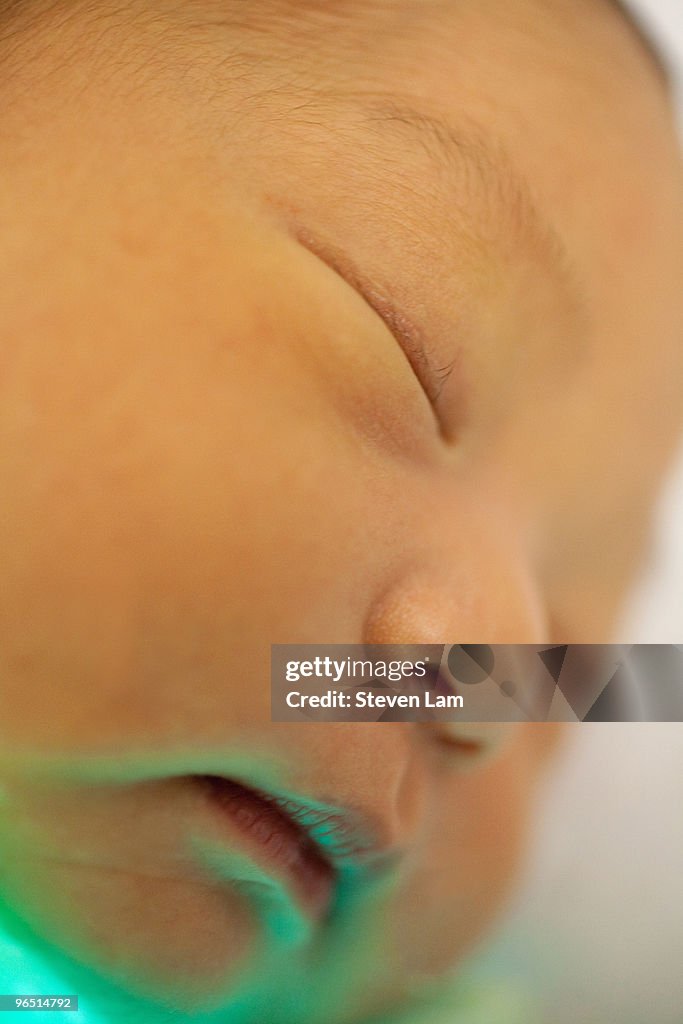 Newborn with jaundice, UV Light treatment