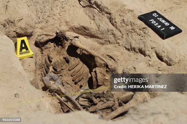 Forensic personnel from the Chihuahua Public Prosecutor's Office work at a clandestine grave where the remains of a person, minus the skull, were...