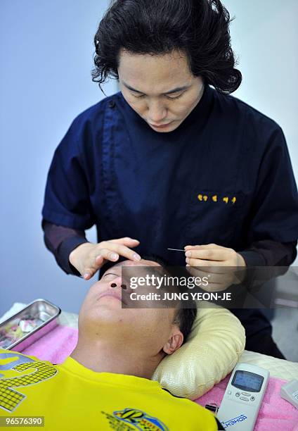 Health-medicine-tourism-SKorea,FEATURE, by Lim Chang-Won An Asian man receives acupuncture treatment on his face during a medical tourism expo in...